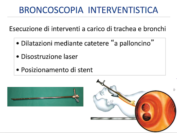 Tecniche di broncoscopia operativa